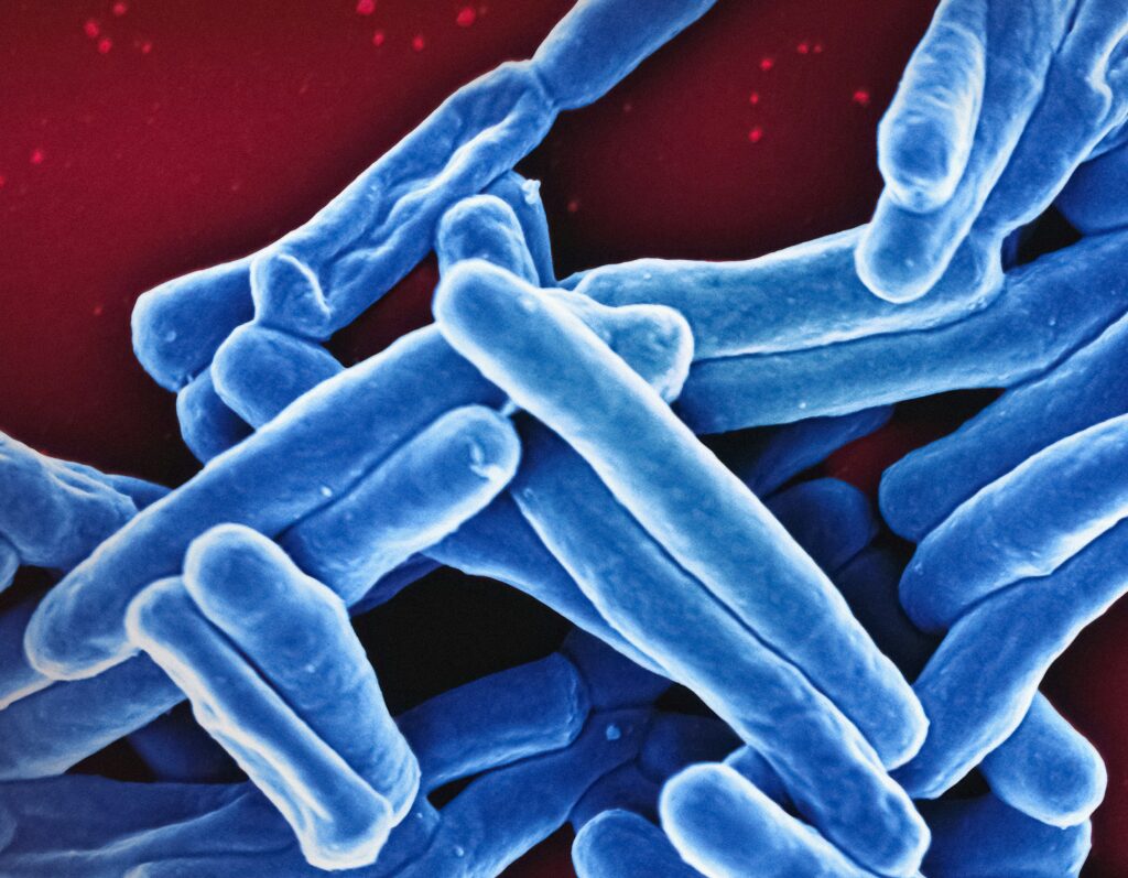 MNT-mycobactéries-non-tuberculeuses-mycobactéries-atypiques-association-patients-MNT